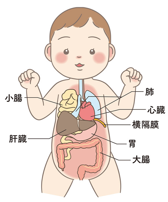 右横隔膜ヘルニア