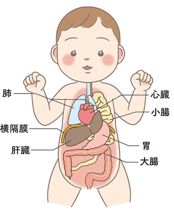 左横隔膜ヘルニア