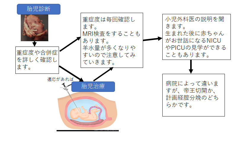 胎児診断から出産まで