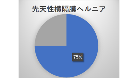 先天性横隔膜ヘルニア